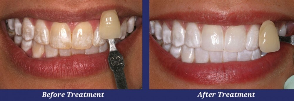 Dental Treatments Encino